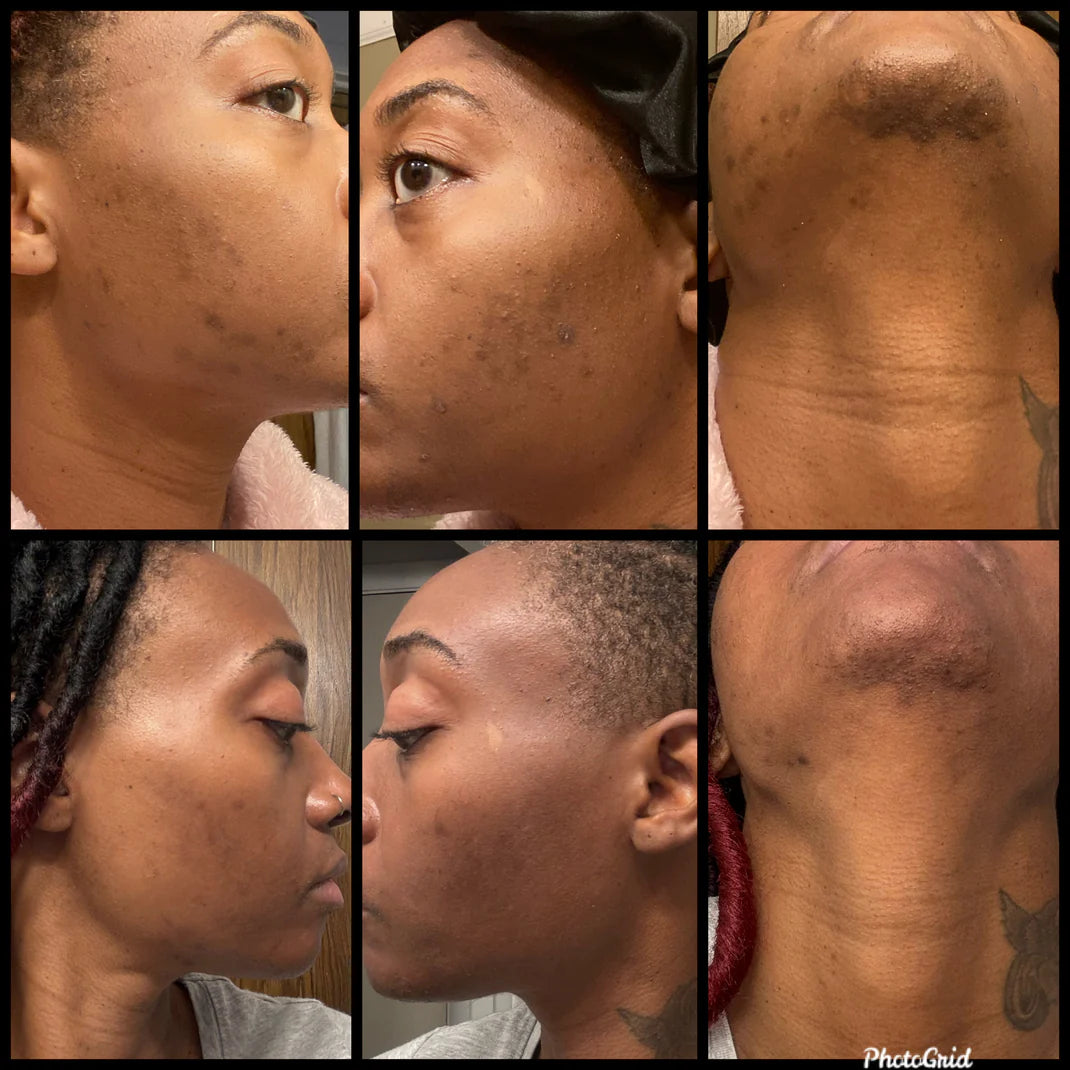The Complete Anti-Dark Spot & Hyperpigmentation Range