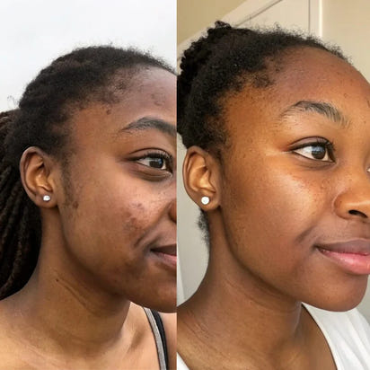 Turmeric Anti-Dark Spot & Hyperpigmentation Soap