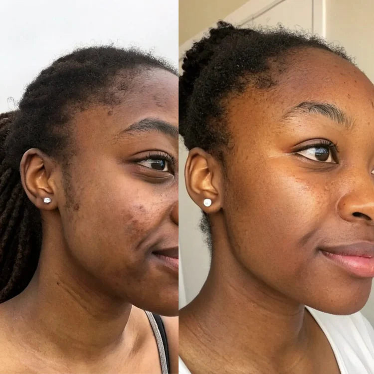 Turmeric Anti-Dark Spot & Hyperpigmentation Soap