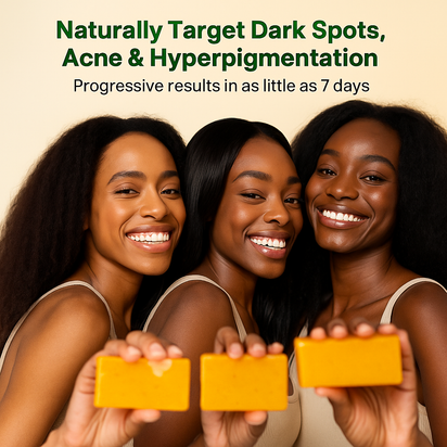 Turmeric Anti-Dark Spot & Hyperpigmentation Soap
