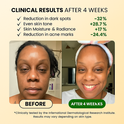 Turmeric Anti-Dark Spot & Hyperpigmentation Soap