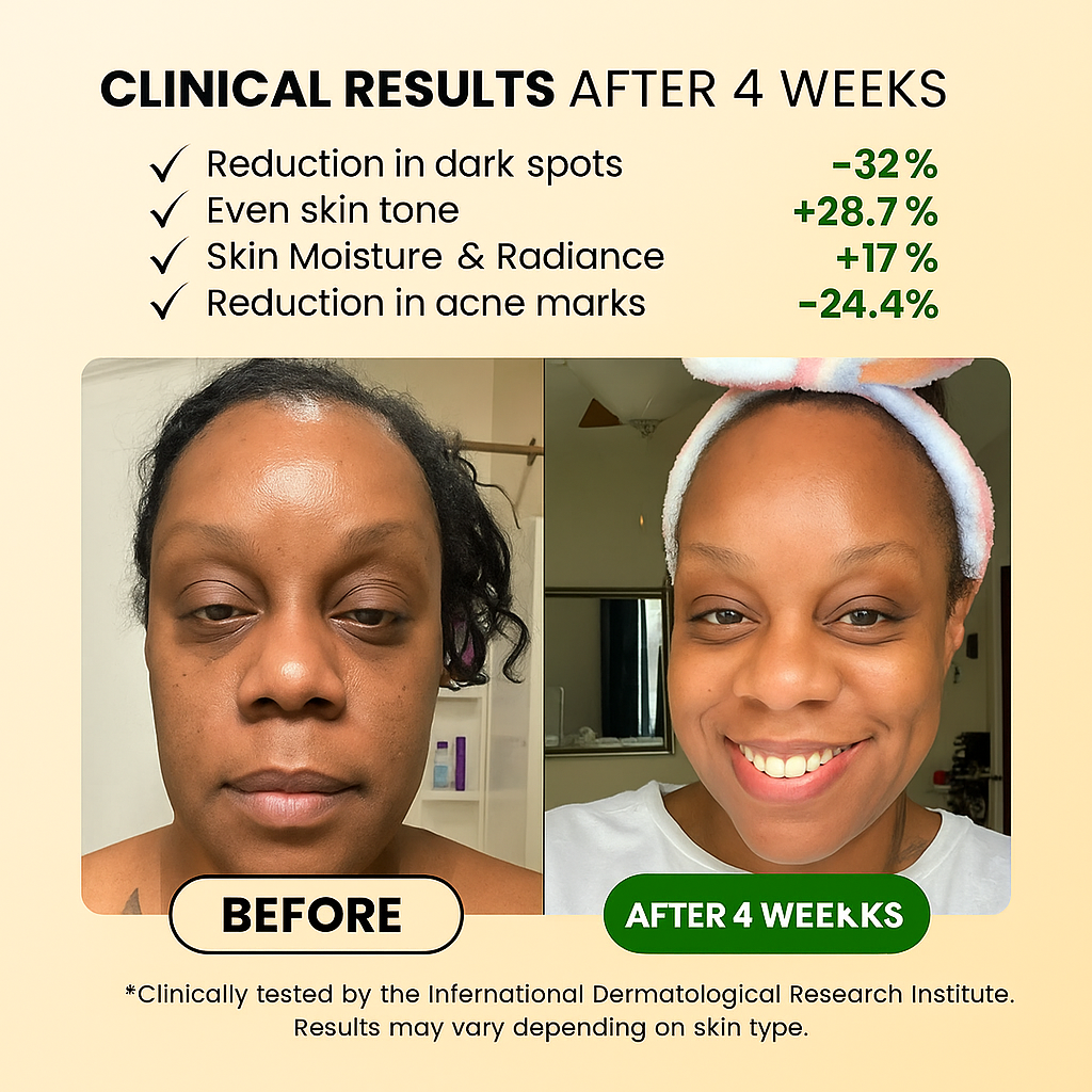 Turmeric Anti-Dark Spot & Hyperpigmentation Soap