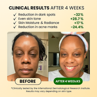 Turmeric Anti-Dark Spot & Hyperpigmentation Soap