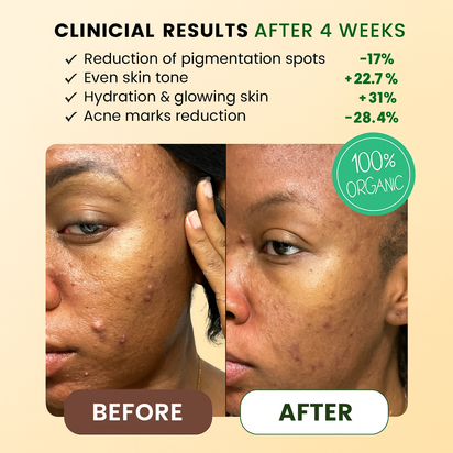 Turmeric Brightening Foam Cleanser