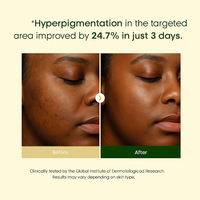 Turmeric Glow Peel-Off Night Mask