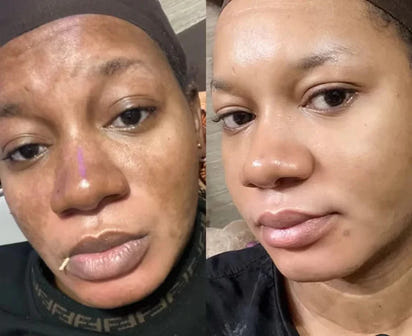 Turmeric Anti-Dark Spot & Hyperpigmentation Soap