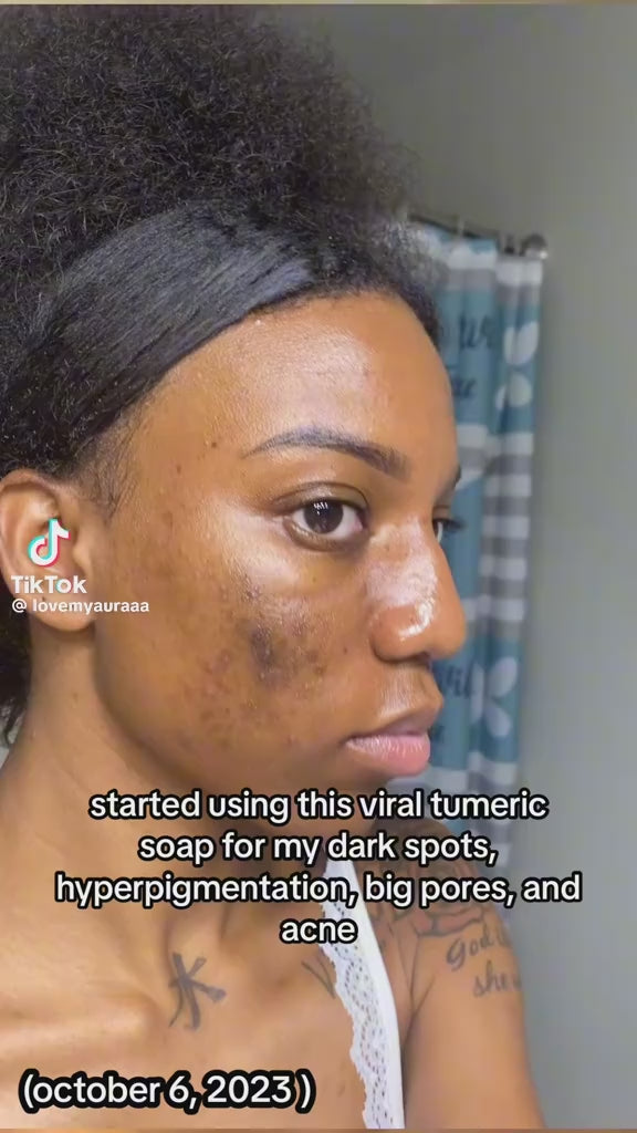 Turmeric Anti-Dark Spot & Hyperpigmentation Soap video