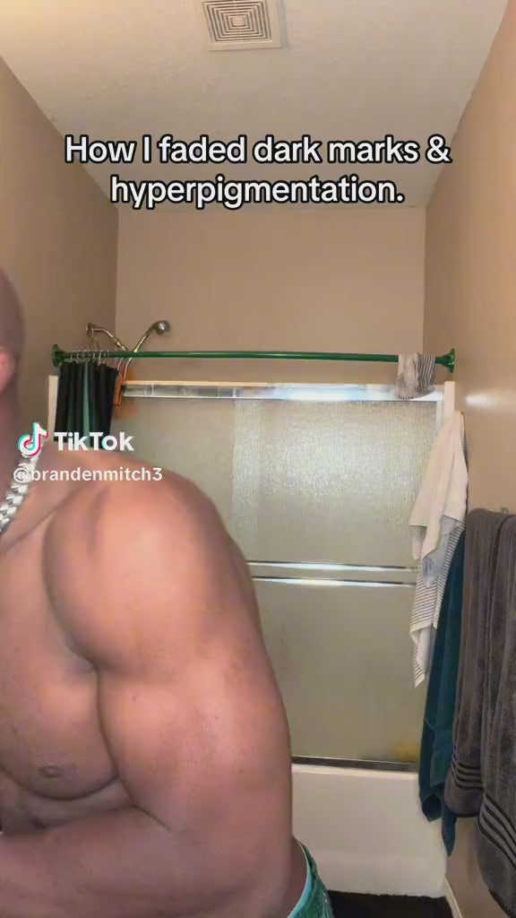 Turmeric Anti-Dark Spot & Hyperpigmentation Soap video